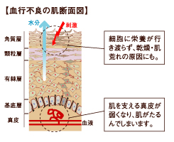 血行不良の肌断面図